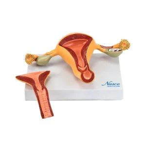 SKU: MG36026  Uterus with Ovary Model, 2-Parts