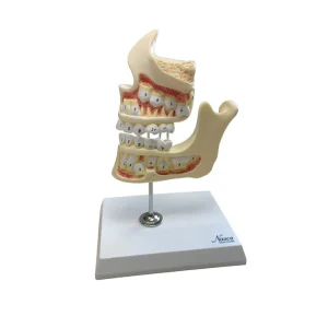 SKU: MG36200  Development of Dentition Models Set, 4 Stages