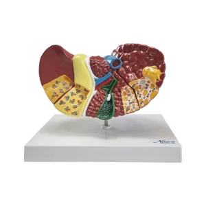 SKU: MG36908  Liver Section with Pathologies Model