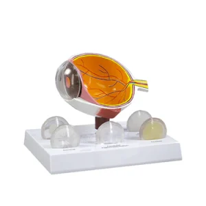 SKU: MG38396  Eye with Cataract Model