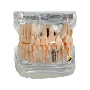 SKU: MG38398  Translucent Adult Dentition Normal and Pathology Model