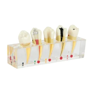 SKU: MG39443  Endodontics Dental Model, 5 Parts