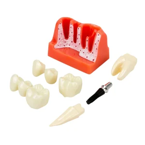 SKU: MG39444  Dental Implant Model, 8 Parts