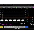 Philips IntelliVue MX800 Patient Monitor Screen Simulation for REALITi 360