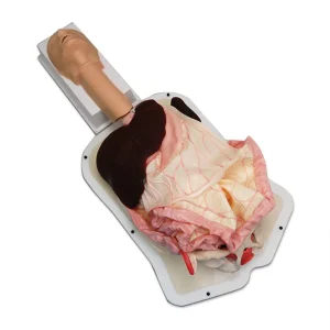 Advanced Abdominal Surgery Trainer – AST (#2147)