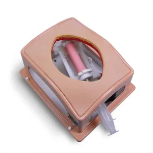 Belly Case (#2170)