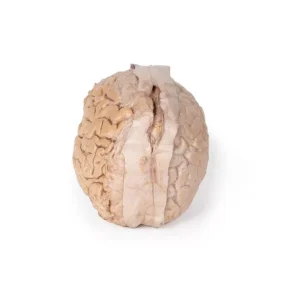 Brain (Cerebrum)