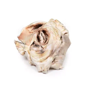 Calcified Aortic Valvular Stenosis Bicuspid Aortic Valve