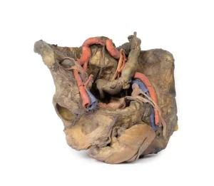 Female pelvis deep dissection
