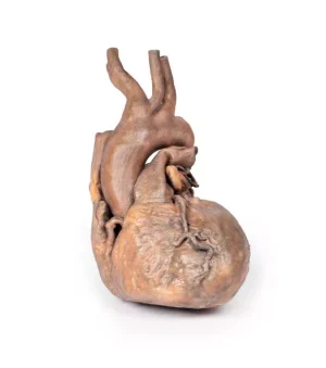 Heart