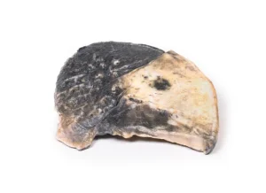 Lobar pneumonia