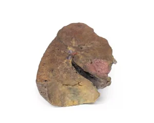 Lung Slab, Hilum removed