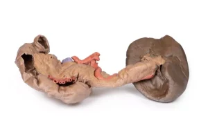 Spleen and pancreas
